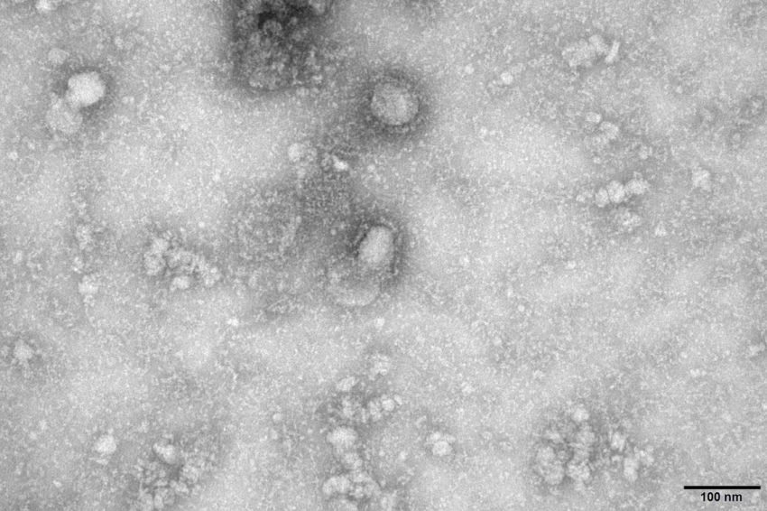 Testes em brasileiros trazidos da China dão negativos para coronavírus