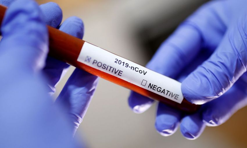 Com novo caso confirmado, sobe para 16 o número de infectados pelo novo Coronavírus