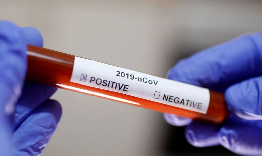 SES registra 189 novos casos de Covid-19 e mais seis óbitos