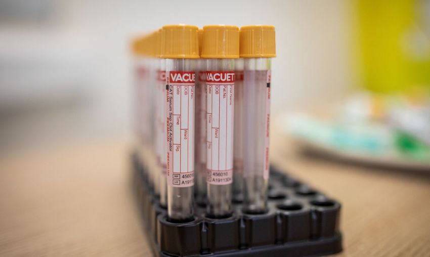 Covid-19: Brasil registra 552 óbitos e 30.476 novos casos da doença