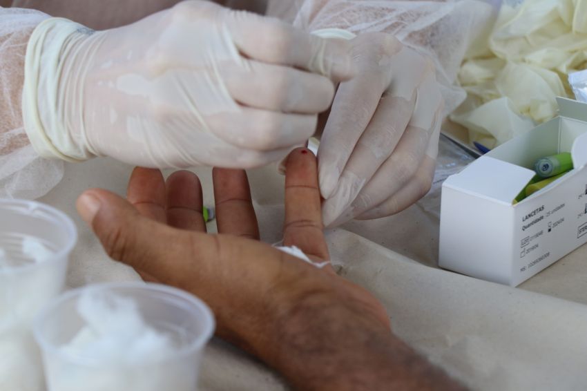 Mais de 32 mil exames para detecação da covid-19 já foram realizados em Aracaju