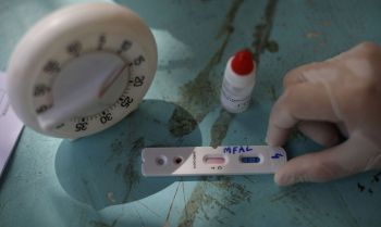 Justiça derruba liminar que obrigava planos a cobrir teste sorológico para Covid-19