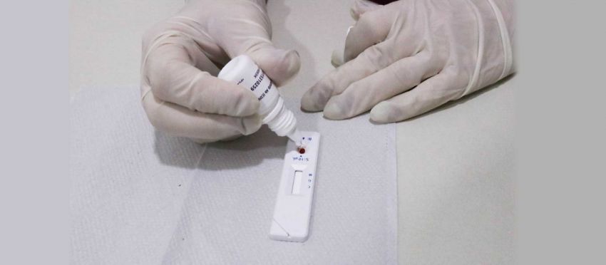 Secretaria de Saúde registra 1.470 novos casos de Covid-19 e mais duas mortes nesta quinta