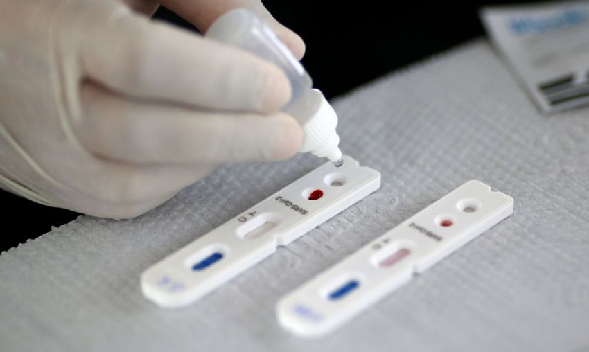 Sergipe é o 2º do Nordeste que mais testa para a Covid-19