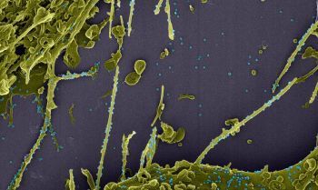 Cientistas encontram variante inédita do novo coronavírus com origem no Amazonas