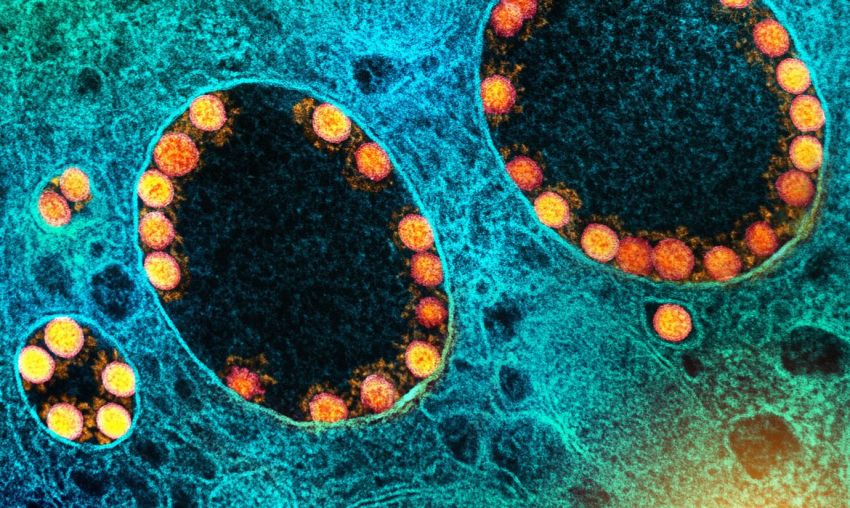 Moderna avança em duas potenciais vacinas da Ômicron