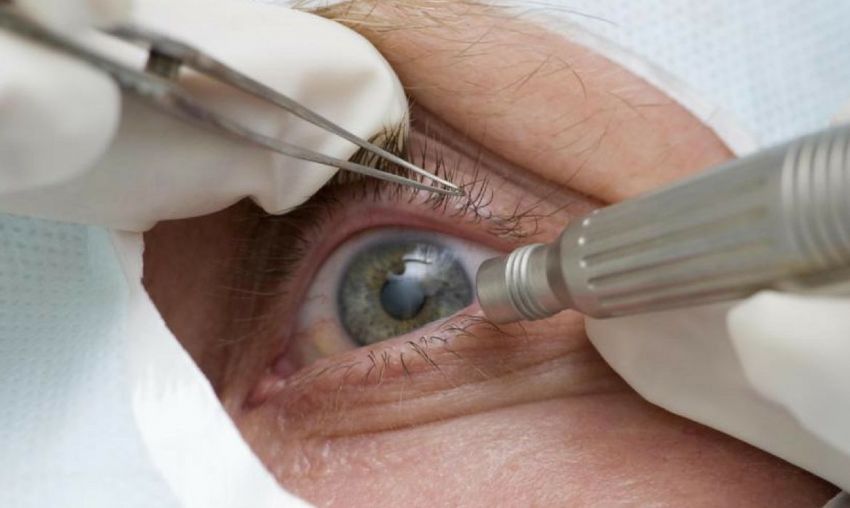 Mutirão fará 6 mil cirurgias em Sergipe