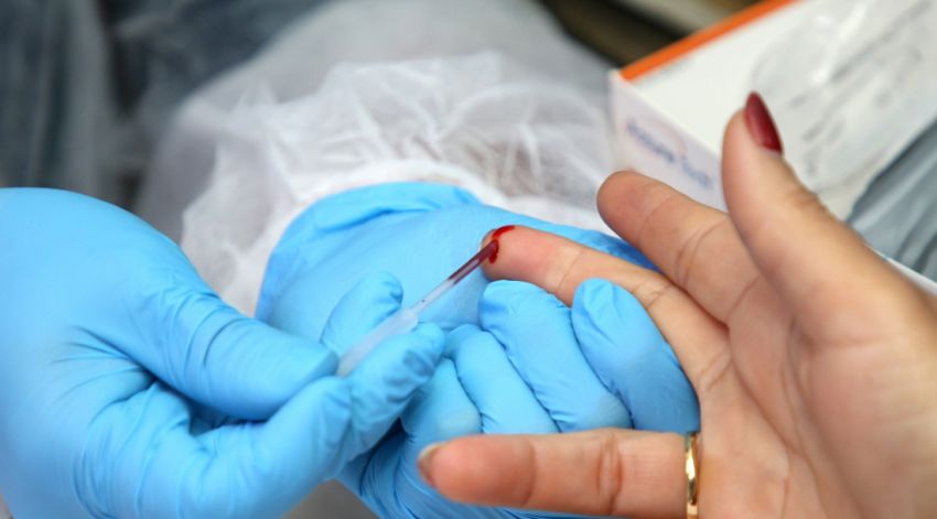 Testes rápidos para detecção de ISTs são disponibilizados na Vila do Forró