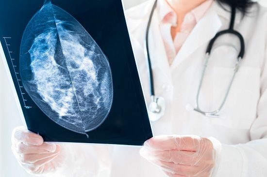 Socorro realiza mutirão de mamografias gratuitas neste sábado