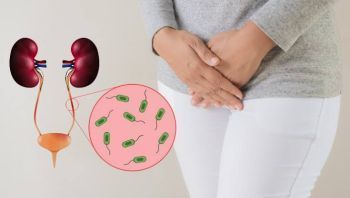 Infecção urinária pode afetar gravemente os rins; saiba identificar a pielonefrite