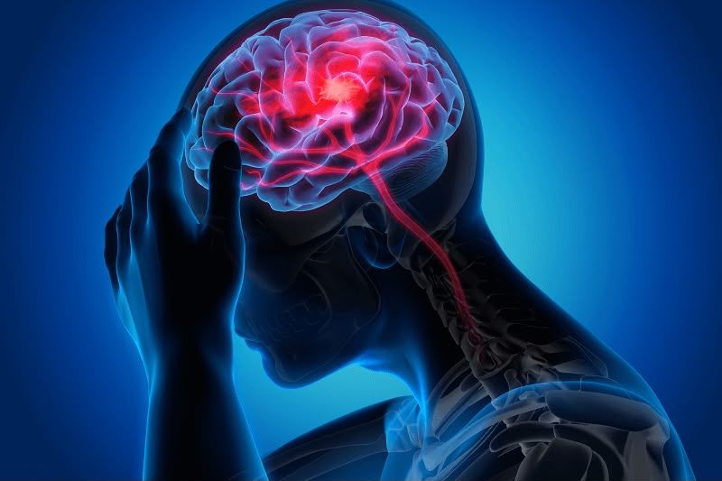 Dia Mundial do AVC: Neurologista orienta sobre os sinais da doença e as formas de prevenção